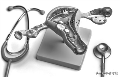 子宫肌瘤怀孕并不可怕,怀孕后发现子宫肌瘤的概率