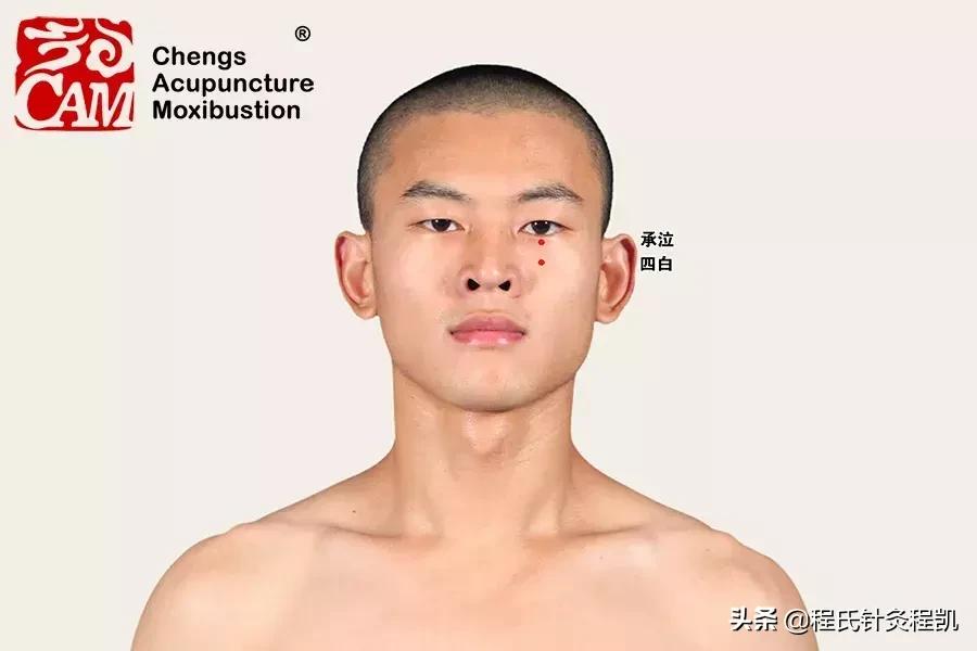 针灸治疗黄斑病变,视网膜黄斑变性的针灸治疗