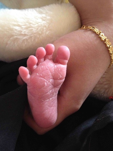 宝宝体重减轻了但不发烧,宝宝体重增加不明显