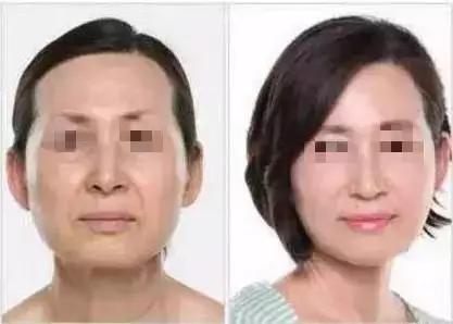 张宗学线雕视频,张宗学线雕第一人