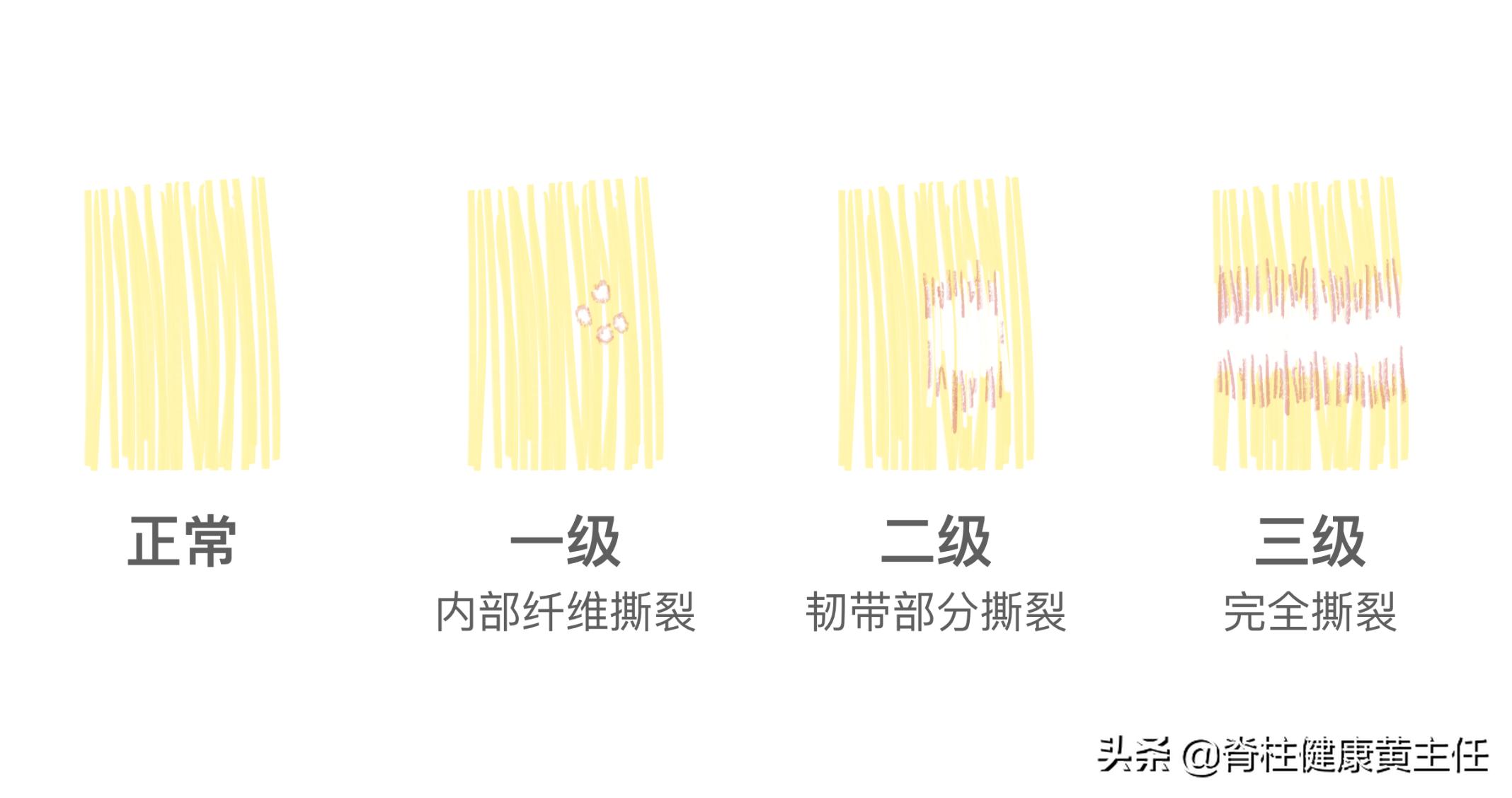 脚踝扭伤大半年还隐隐作痛，应该怎样处理？