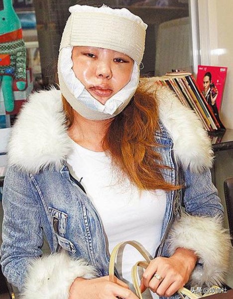 掌掴林心如，爱马仕当垃圾袋，我们每买一件阿迪都是给她送钱