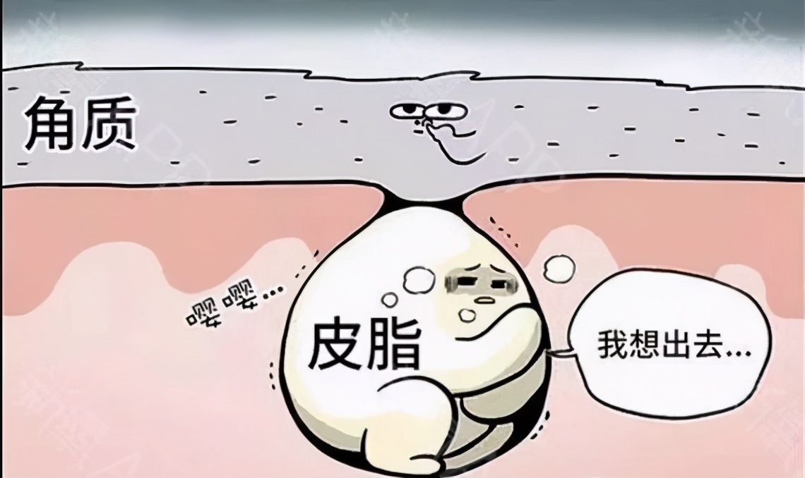 被挤发炎的闭口怎么处理,被挤了的闭口粉刺如何快速好