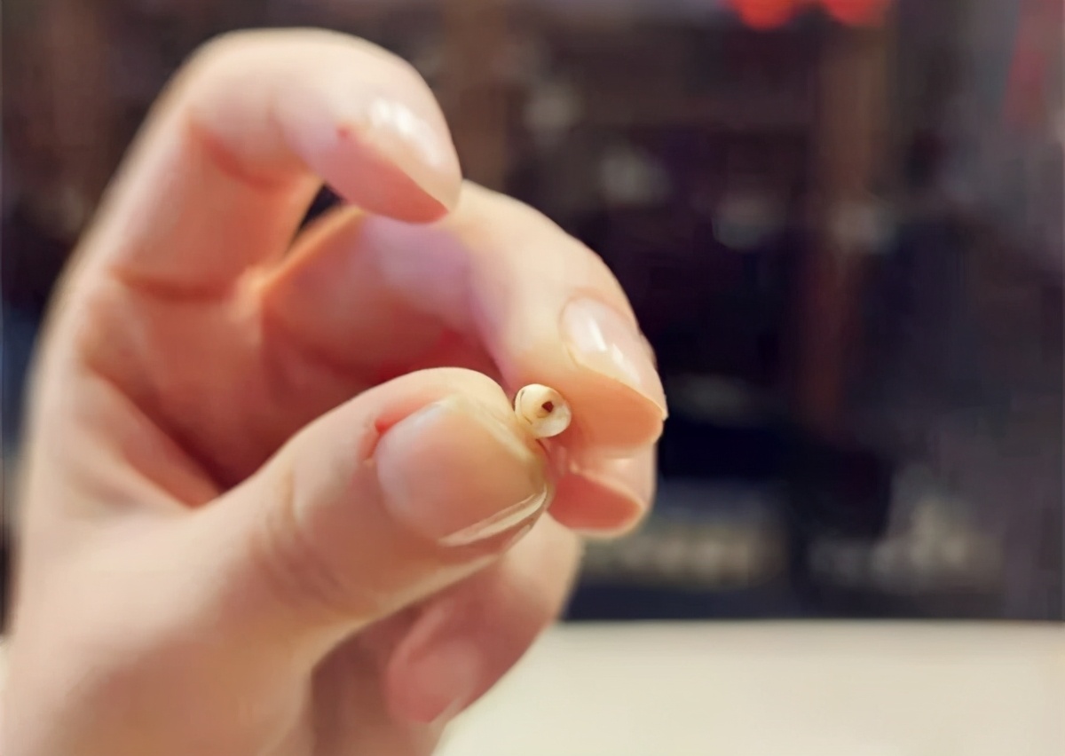 为什么乳牙好换牙就不好了,为什么现在的孩子换的门牙特别大