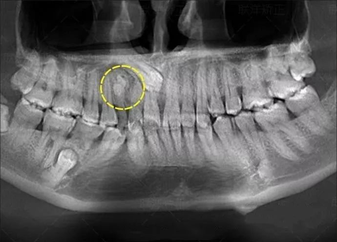 看牙不拍片直接说费用,医院看牙拍片贵吗