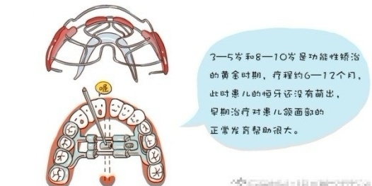 牙齿歪七扭八大小不一能矫正吗,牙齿歪90度是怎么整过来的