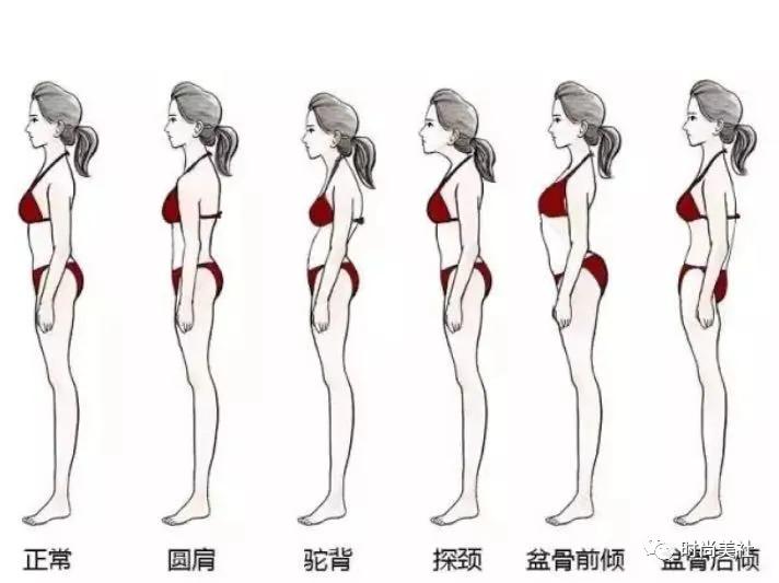 天生脖子短是不是没救了,脖子短还可以拯救吗