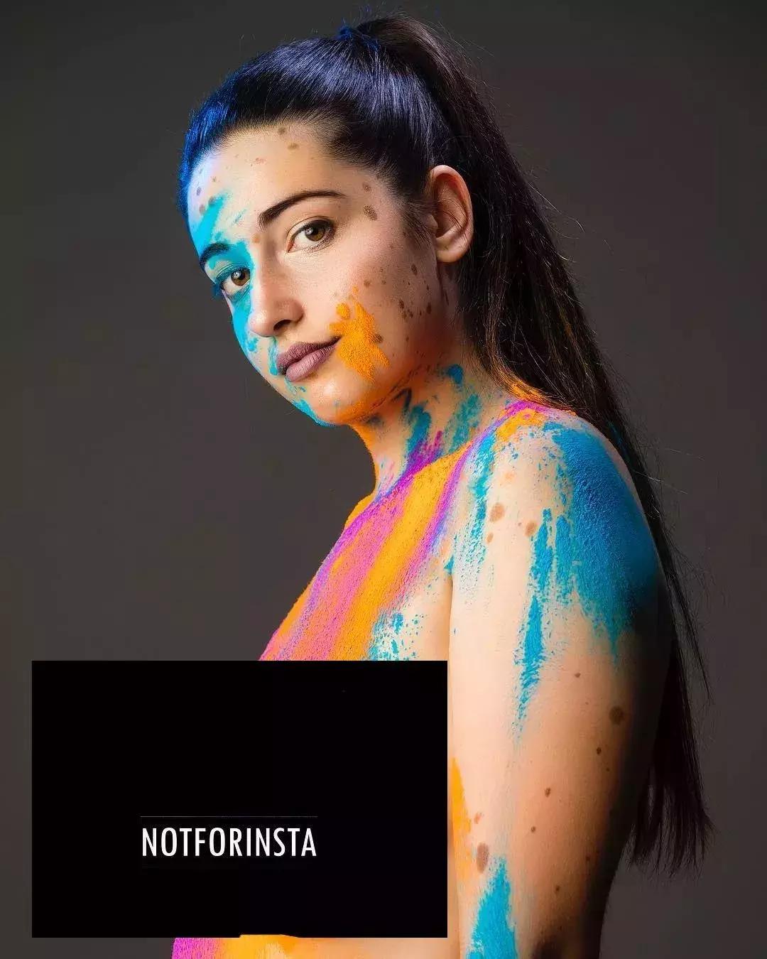 全身黑斑被骂“斑点狗”，身高160的她却成为最美超模…