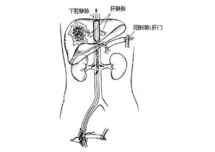 致敬吴孟超中国肝胆外科之父,中国肝胆外科之父吴孟超逝世