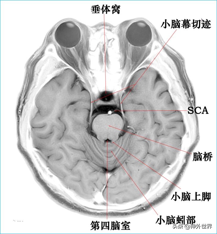脑解剖学讲解视频全集,脑功能解剖学习