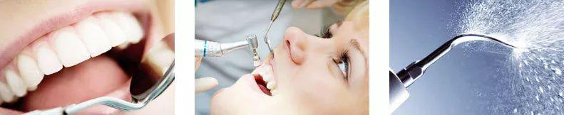 保定这个地儿，9.9元做超声波洁牙！还不去给你的牙齿洗个澡吗？