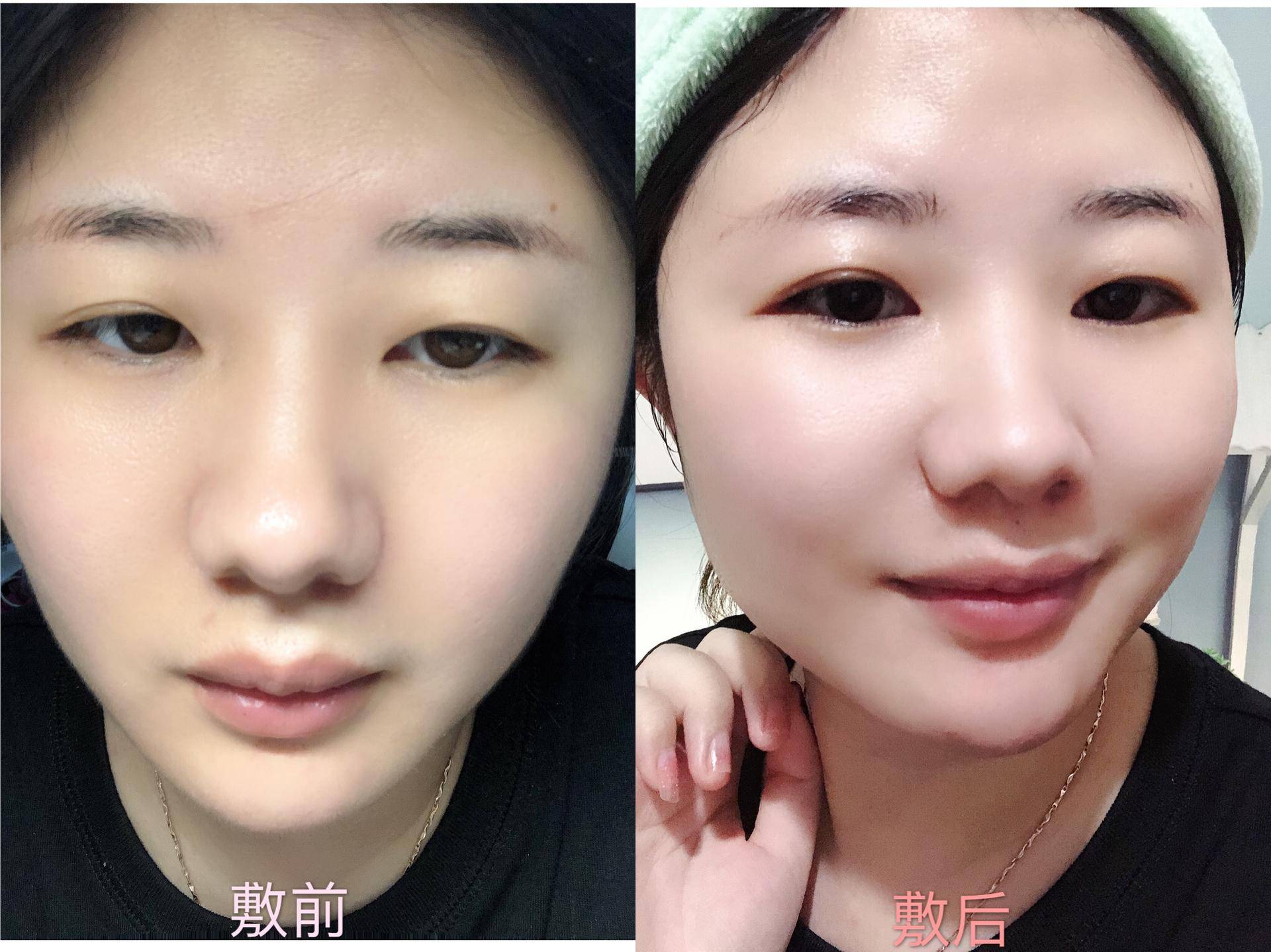 肌肤优化医用冷敷贴,脸部医用冷敷贴怎么用效果好