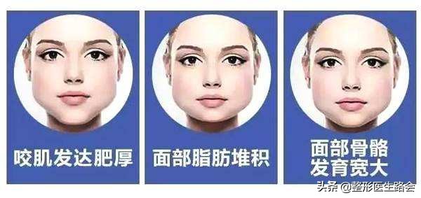 脸又大又宽怎么办,脸短窄怎么治疗