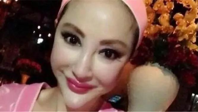 整容自毁前程的女明星,整容失去灵魂的女明星