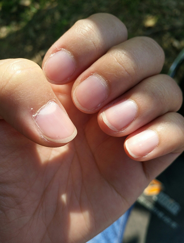 指甲出现问题跟什么脏腑有关,指甲出现问题一定要注意了