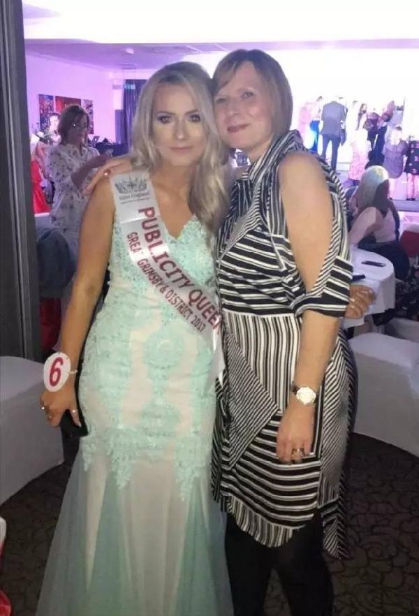 选美皇后是秃子？当众摘下假发引热议！没想到这两个冠军也是秃头