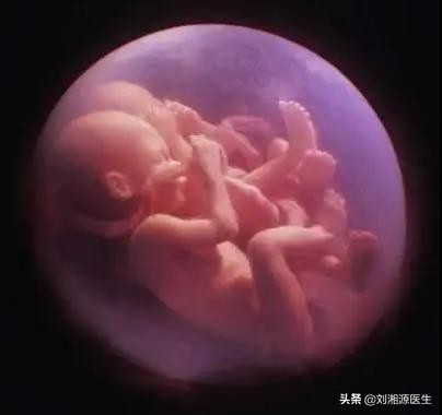 免疫不良妊娠诊断为不孕,免疫相关不良妊娠解释