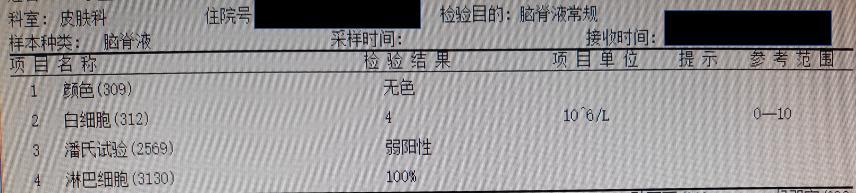 梅毒头疼是神经梅毒吗,神经性梅毒会导致头疼吗