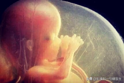 从14岁到17岁,从14岁到22岁