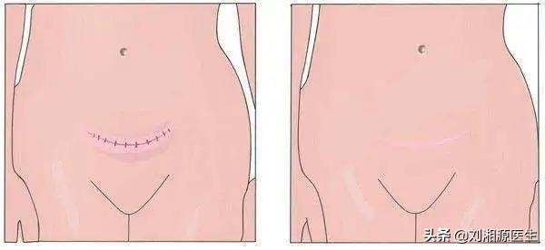 免疫性不良妊娠保胎成功,免疫治疗不良妊娠的方法