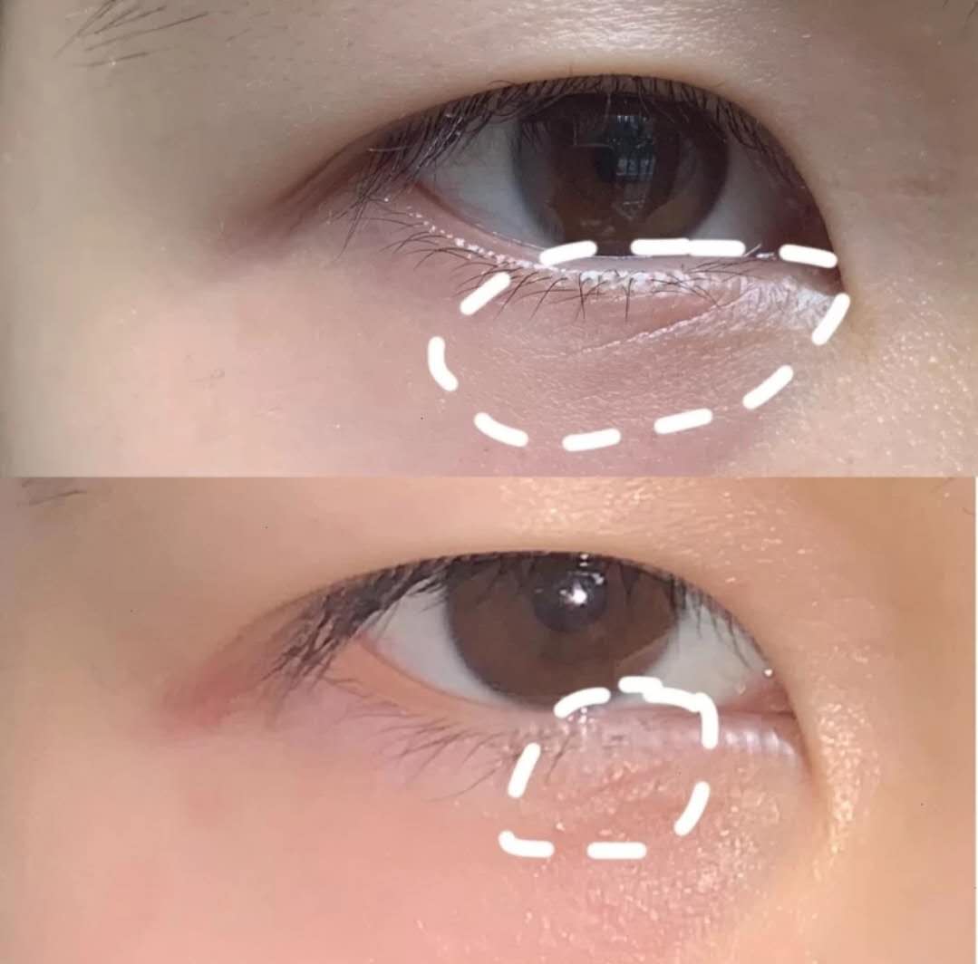 眼下有笑纹的女人好不好,笑纹多的女人意味着什么