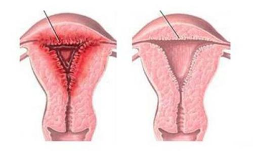 妇科病白带多有异味用什么药,医生问平时白带多不多怎么回事