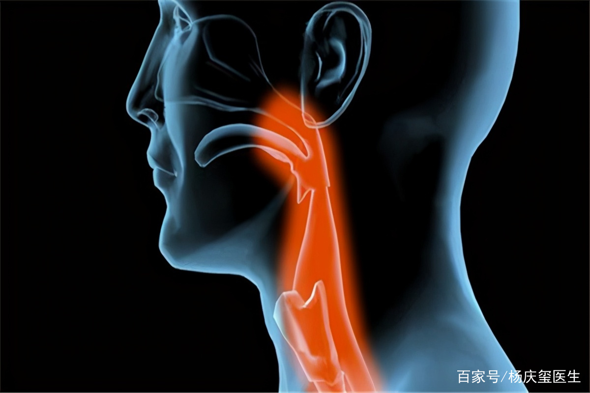 缓解上火用的牛黄解毒片，还能应对哪些问题？多学点或许能用到