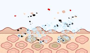 用香皂洗脸去油祛痘,硫磺香皂洗脸可以祛痘去油吗