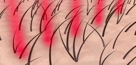 疯狂掉头发发际线后移,疯狂掉头发头发变得稀疏