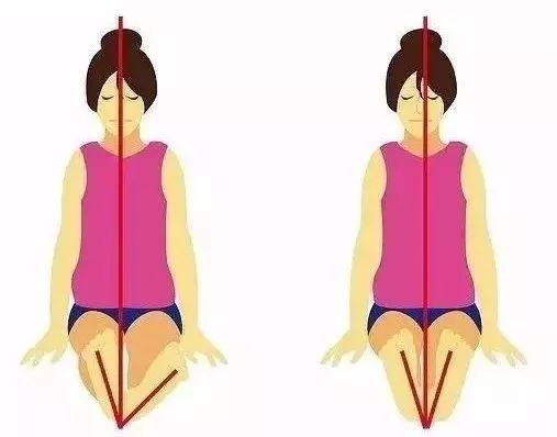 骨盆倾斜能根治吗,骨盆歪斜影响生育吗