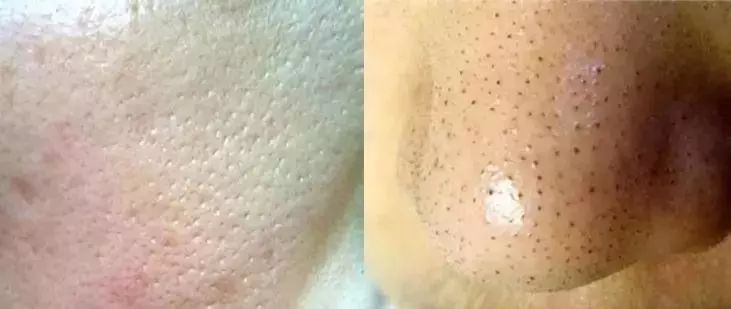 还在用洗面奶洗脸卸妆就out了！用它轻轻一刷，几秒就能深层清洁每个毛孔，感觉黑头都蹦出来了！