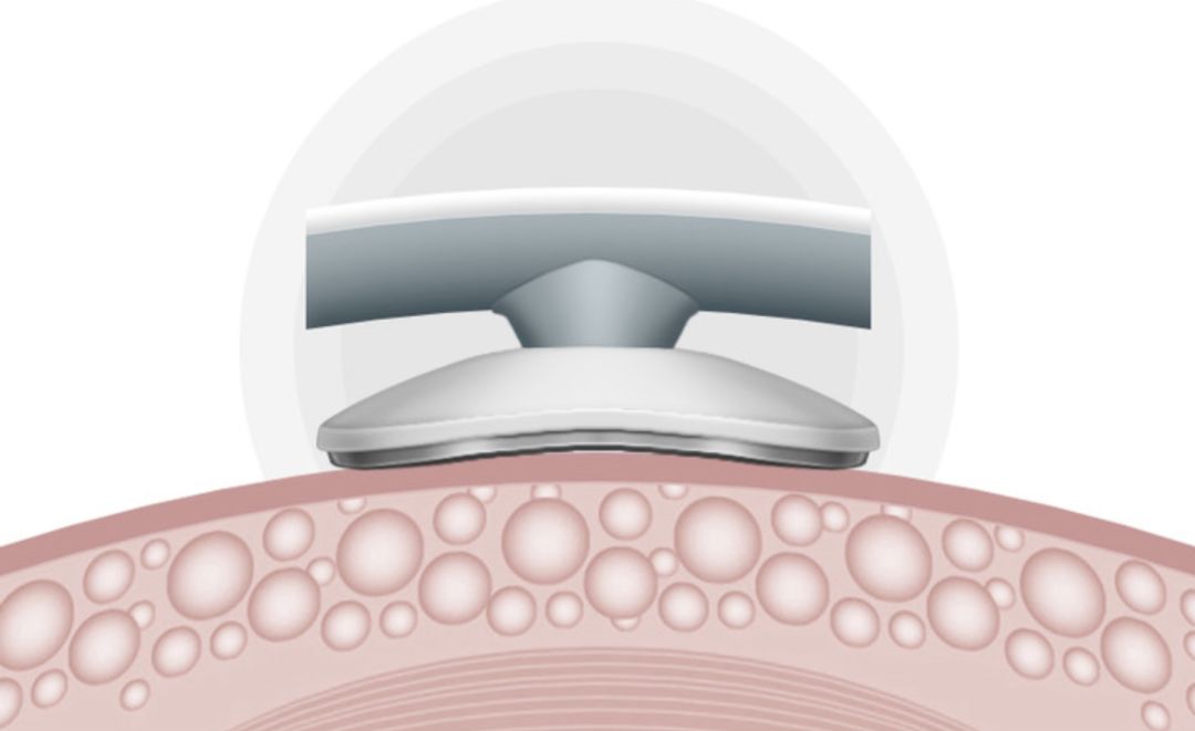 熬夜加班按摩,熬夜低头玩手机颈椎病