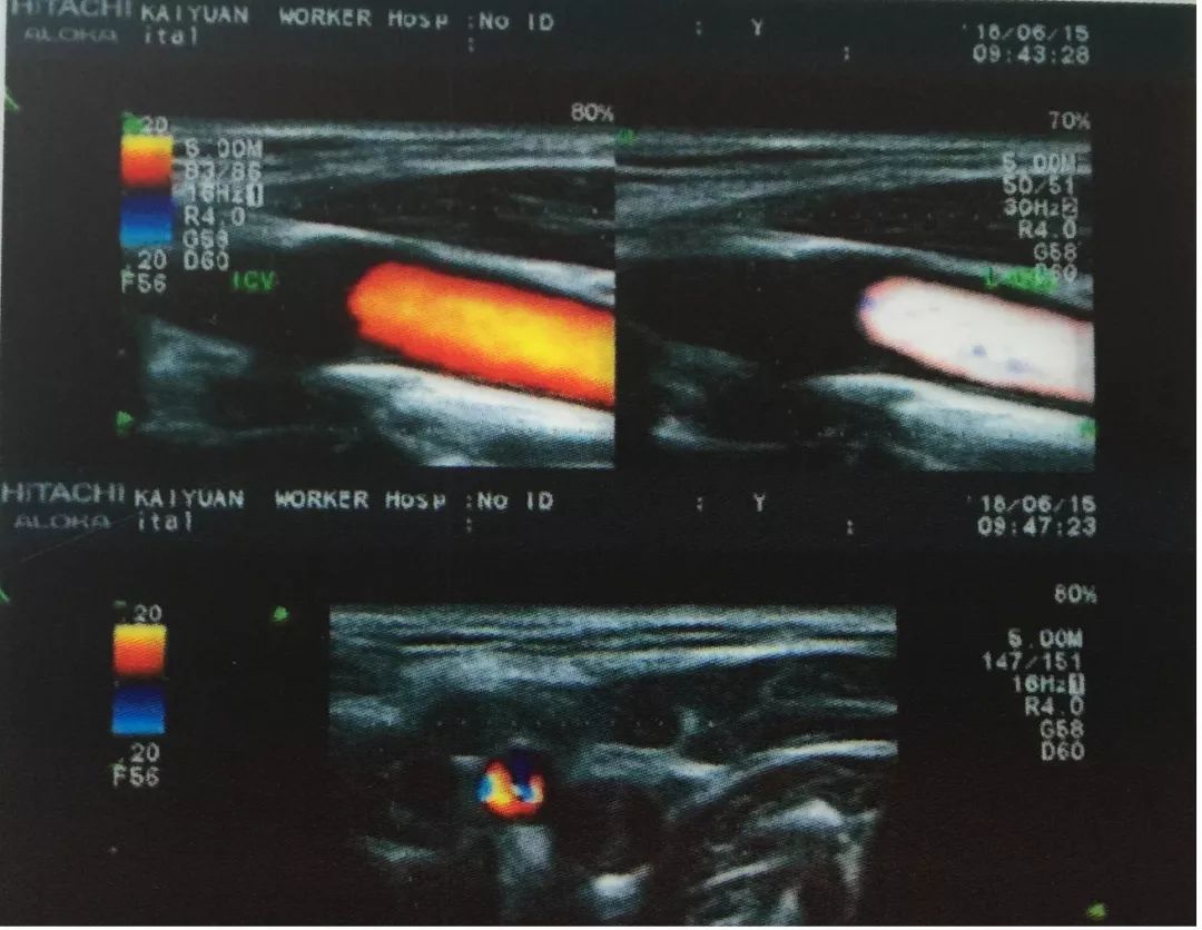 我州这类病患快看！开远这个医院有超赞的“医疗设备+专家诊断”，治疗更专业