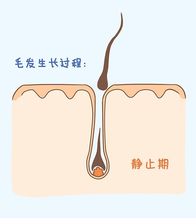 每天差不多掉多少头发算脱发,一天掉多少根头发算脱发