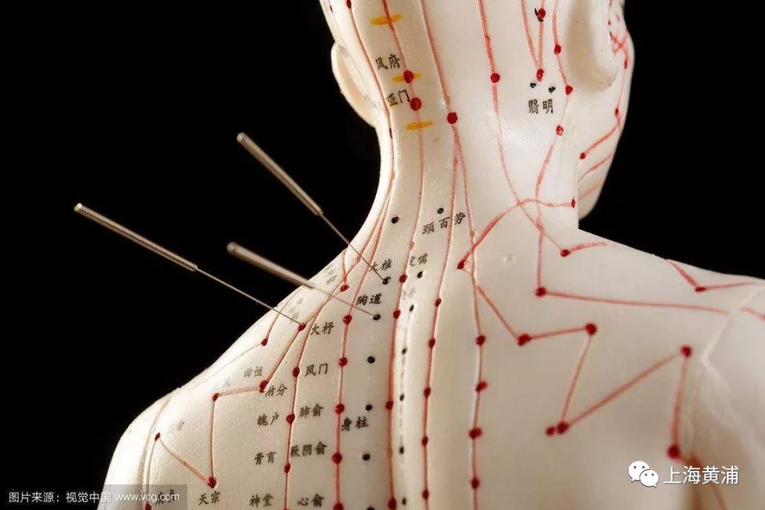 针灸治疗哮喘有效吗,针灸可以治哮喘吗