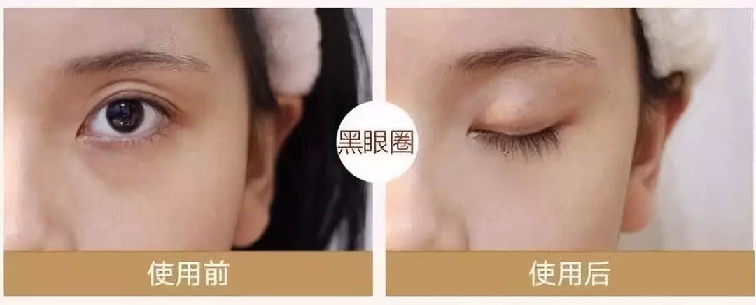 430年马应龙非遗中药眼膜，保密古方，一敷秒去大眼袋