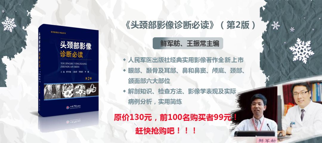 ct检查费住院和门诊价格一样吗,加急ct比普通ct收费贵吗