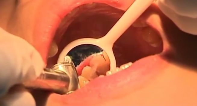 孩子乳牙掉了别扔，赶紧藏好，关键时刻能救急！