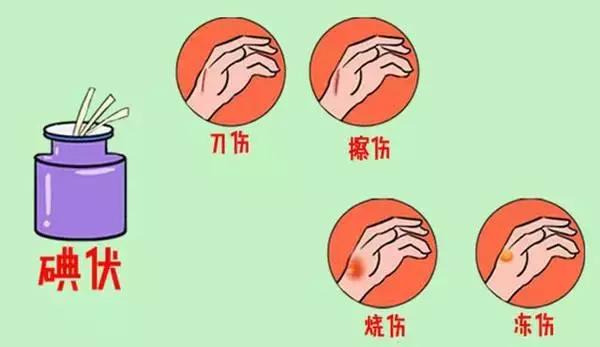 紫药水、红药水、酒精、碘伏……哪种处理伤口好？终于知道了