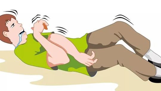 癫痫抽搐监测器,癫痫监测设备