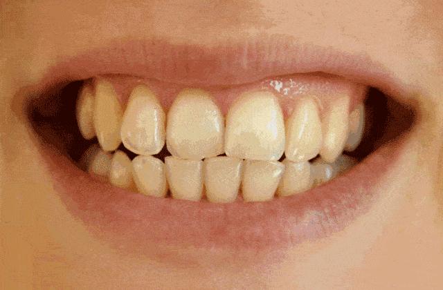 团购|俄罗斯亮白牙膏组合，轻松瓦解多年牙垢，清新口气告别黄牙