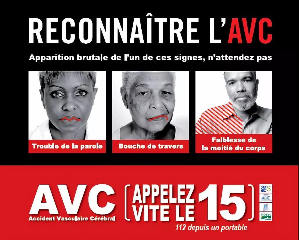 小孩会得中风吗,小孩会得脑中风吗