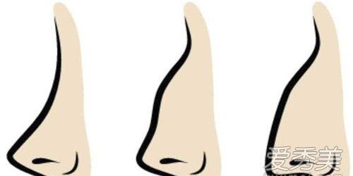鼻子会越挤越大吗,鼻子会越捏越高吗
