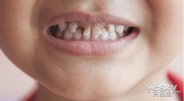 小孩应该多大刷牙,小孩几岁开始刷牙保护牙齿