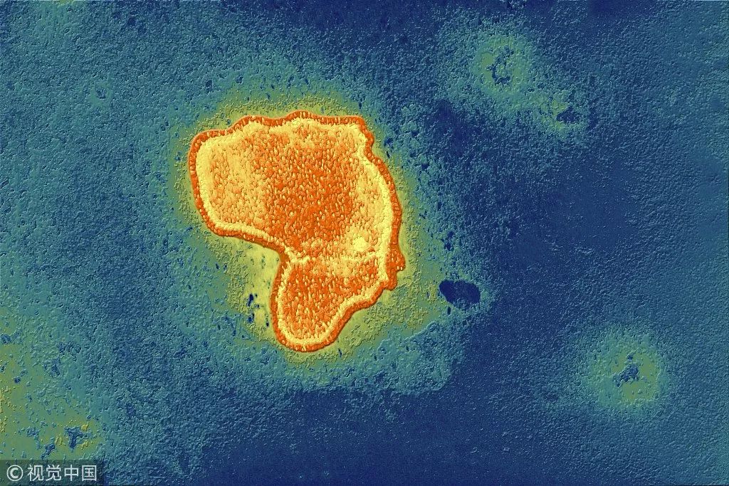 28种药品目录,用药说明书上写的儿童禁用