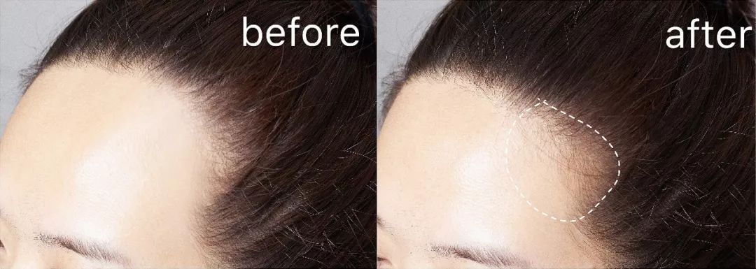 戳进来｜“秃”如其来，除了绝望你还能怎么办？