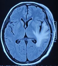 因祸得福第二集,因祸得福上下集免费