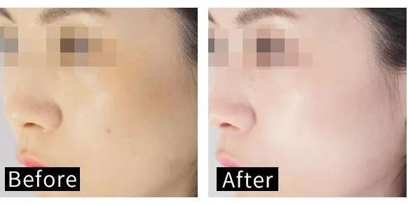 适合黄皮的mm面膜,适合黄皮便宜好用面膜