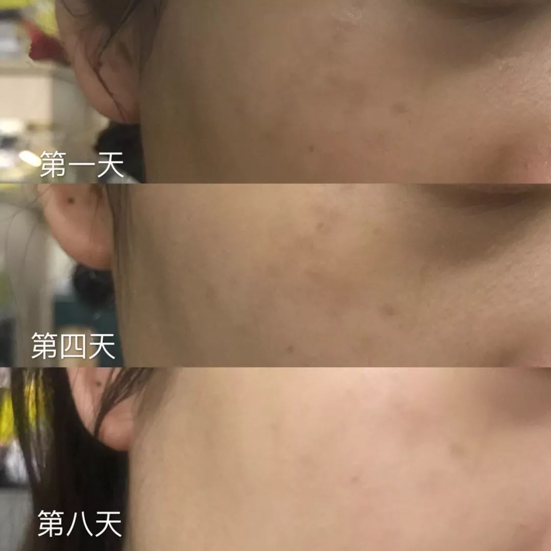 补水保湿滋润肌肤面膜10片装一盒,安瓶精华水润透亮睡眠面膜