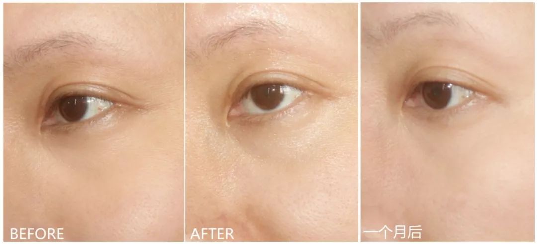 明星同款兰蔻必买清单,兰蔻最爆款单品